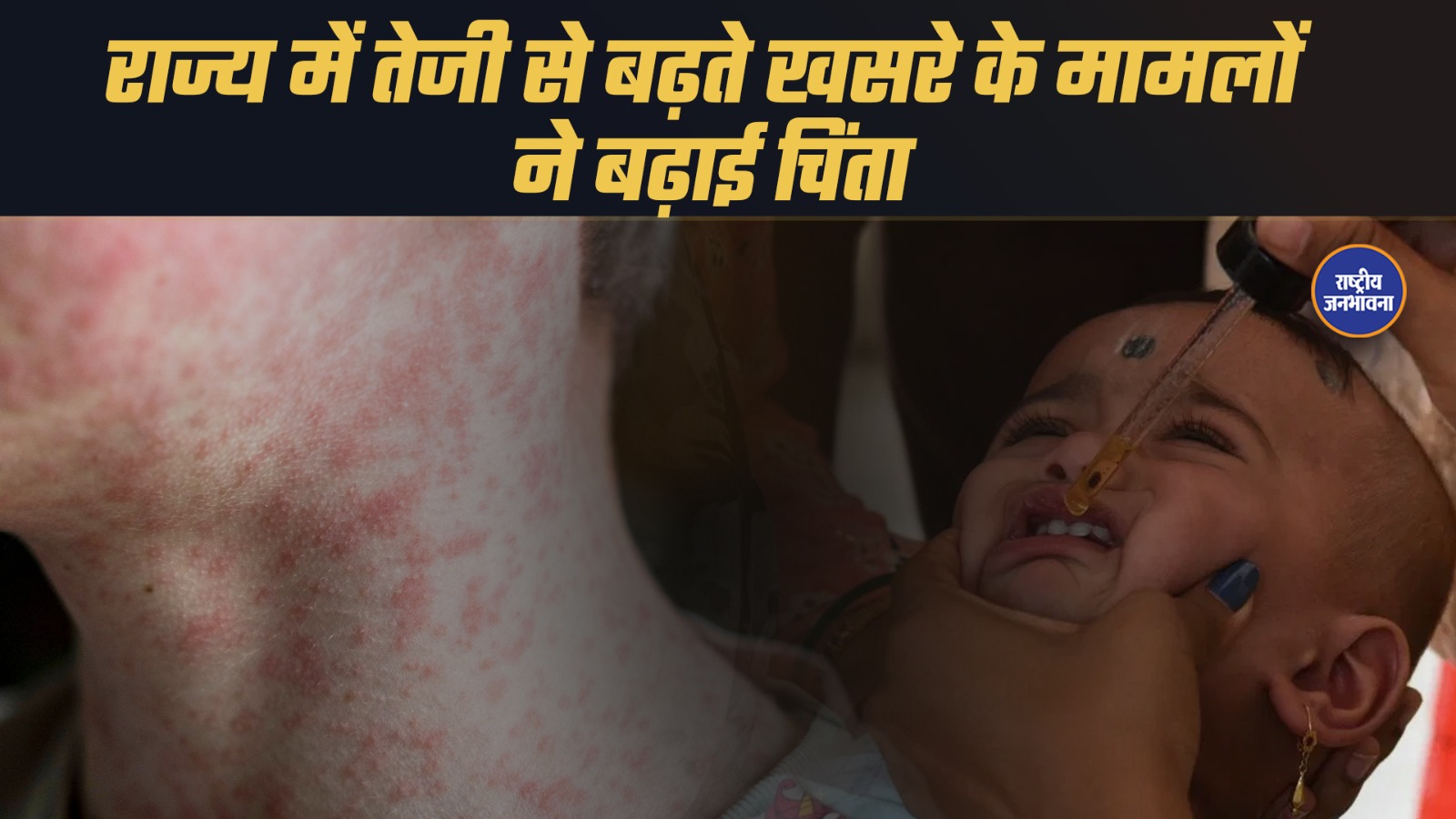 मध्यप्रदेश से बड़ी खबर… राज्य में तेजी से बढ़ रहे हैं खसरे के मरीज, और बच्चों की सुरक्षा को लेकर हाई अलर्ट जारी किया गया है।